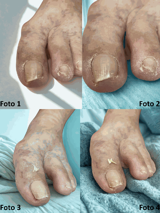 Cuidados para Idosos